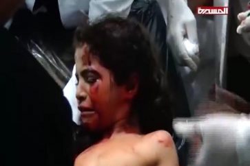 victime_bombe_fragmentation00