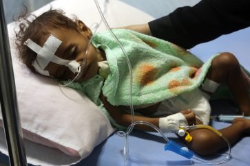 YEMEN-CONFLICT-CHILDREN