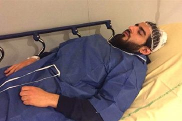 Cameramen iranien blessé à la tête par la police française