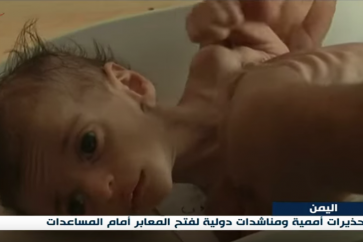 La guerre saoudienne contre le Yémen provoqué la pire crise humanitaire au monde, selon l’ONU.