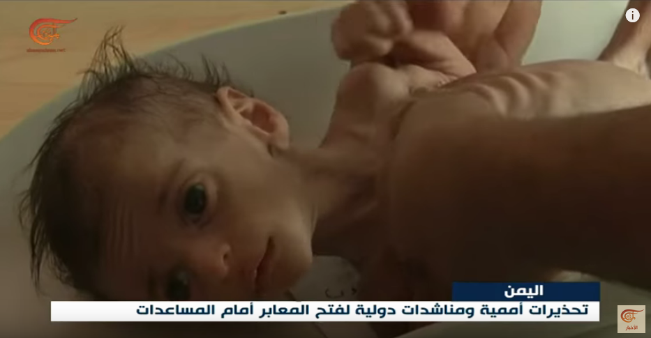 La guerre saoudienne contre le Yémen provoqué la pire crise humanitaire au monde, selon l’ONU.