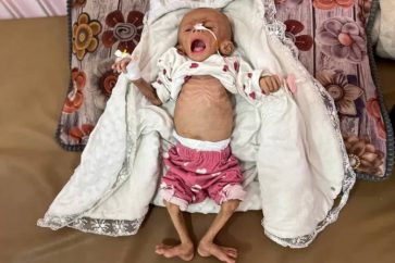 « La terrible famine généralisée qui frappe Gaza, conséquence du blocus israélien, est sans précédent dans l'histoire moderne de l'humanité. »